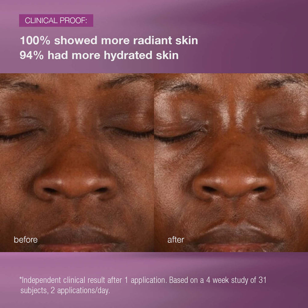 Before and after comparison of a person's skin with clinical proof text on a purple background